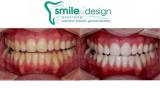 Smile by Design - Bondi Dentist Dentists Bondi Junction Directory listings — The Free Dentists Bondi Junction Business Directory listings  logo